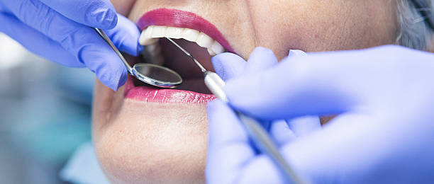 Best Emergency Dental Care for Broken or Chipped Teeth in Pisgah, AL